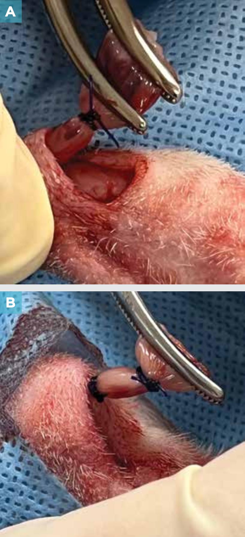 附睾炎切除术多少钱,附睾炎微创手术治疗全过程