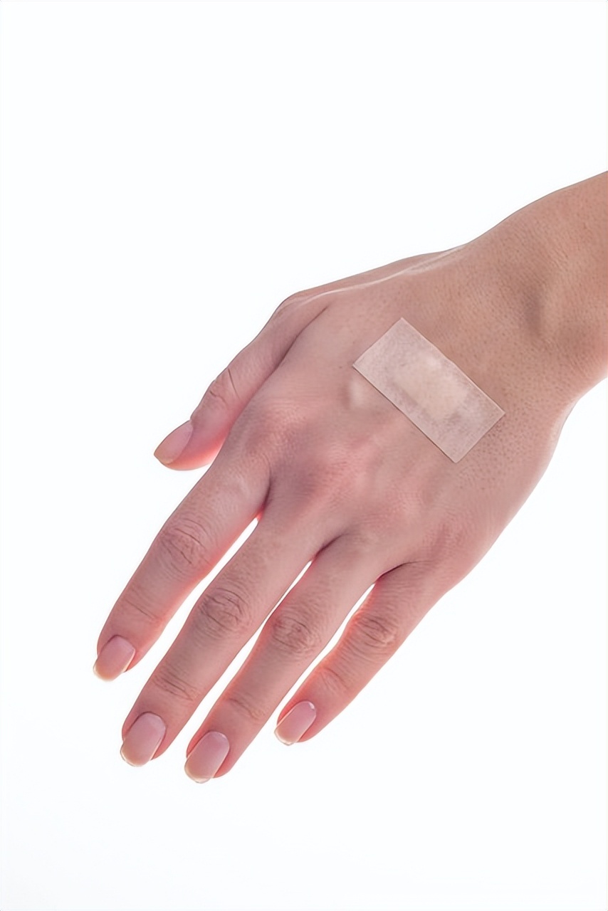 止血后怎么处理划破的伤口,止血棉在伤口里面怎么处理