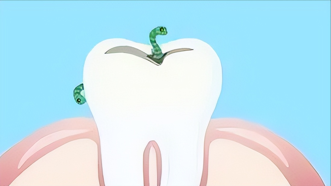 猫咪会长铁线虫吗,猫咪会长蛀牙吗