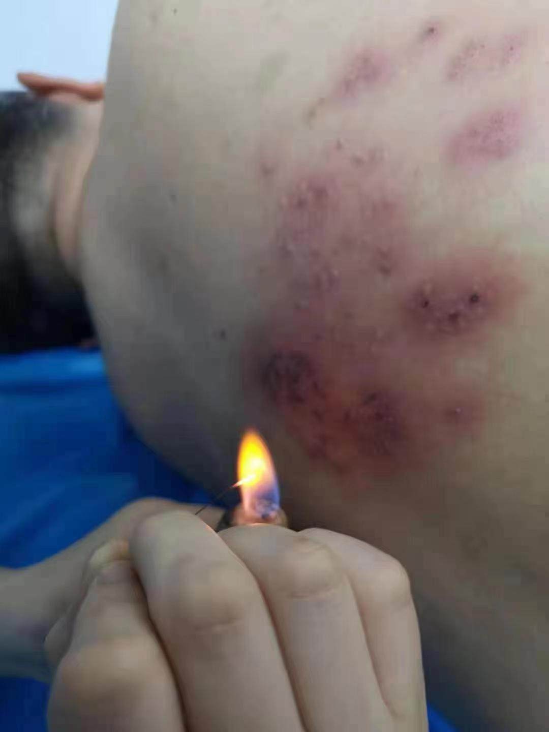 郑州市中医院皮肤科,深耕中医十年