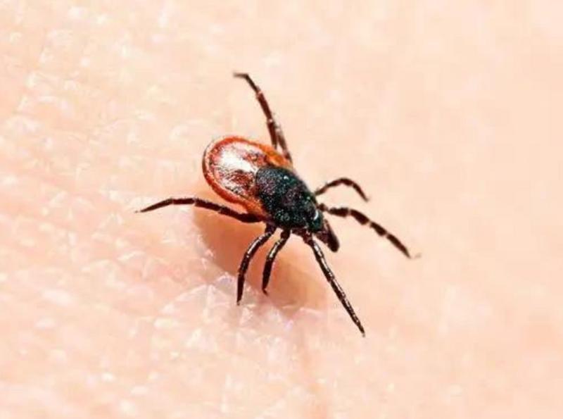 女子腹部痒，医生用镊子夹出16只阴虱！原来阴虱有4个传播途径