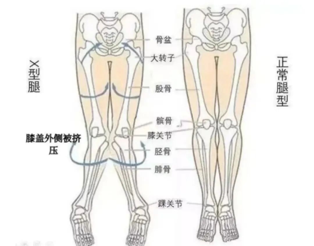 为什么男生的腿都要比女生细,为什么男生都喜欢腿细的女生