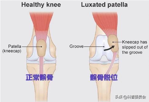 关节发出咯咯的声音,关节发出咯吱咯吱的响声怎么办