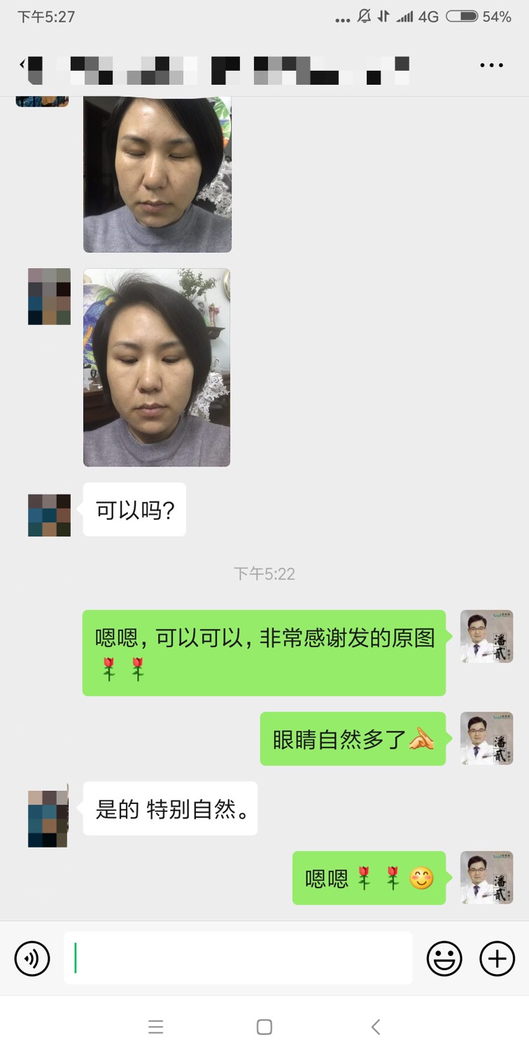 东莞整形做双眼皮,东莞整形医院割双眼皮