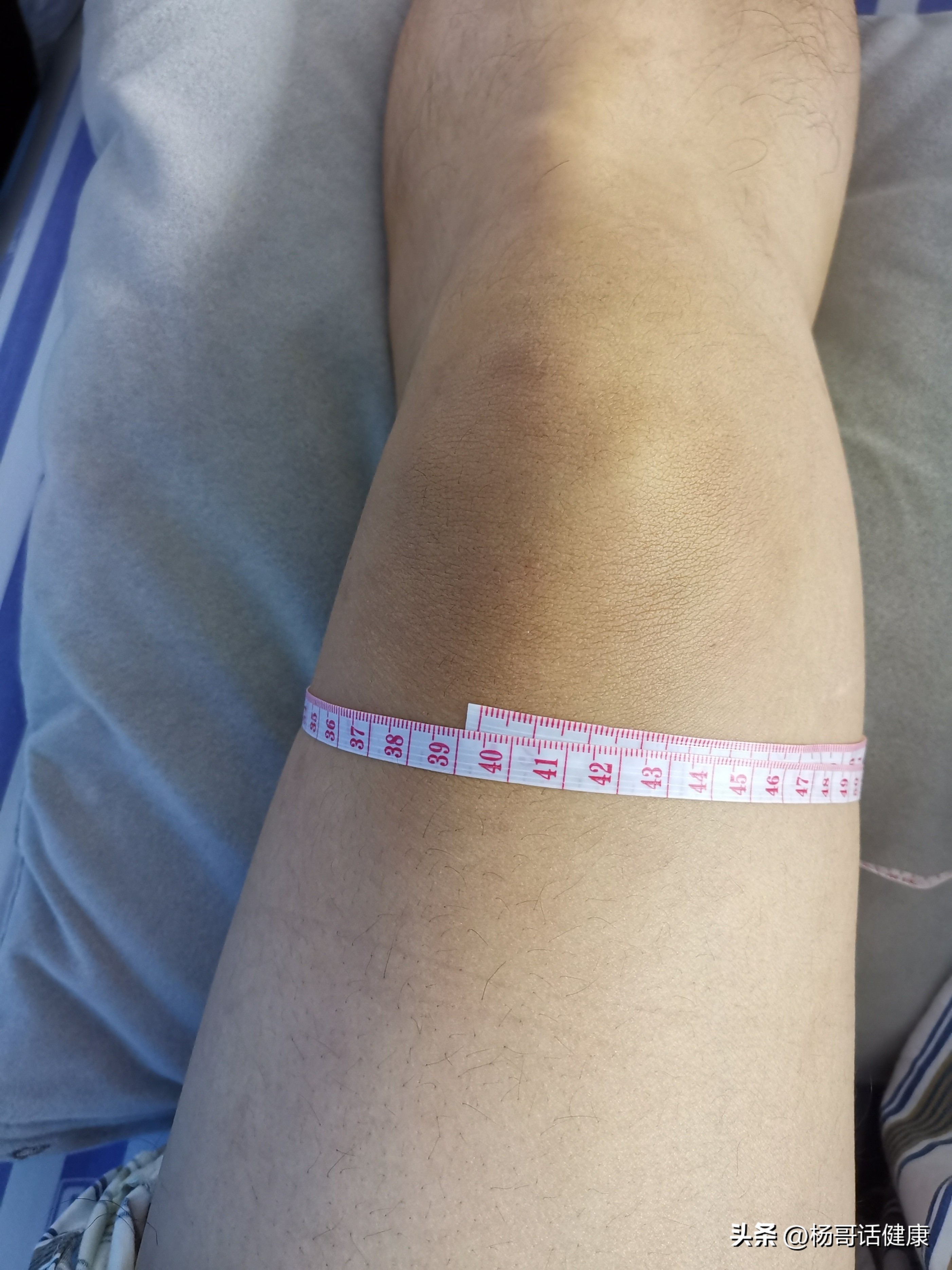 膝关节又犯了疼痛难忍该怎么调理,膝关节不及时调理的严重后果