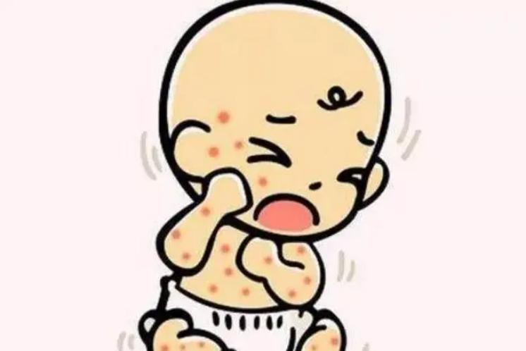 医学科普湿疹做好这几点减少复发,谈谈湿疹的中医药防治与调养
