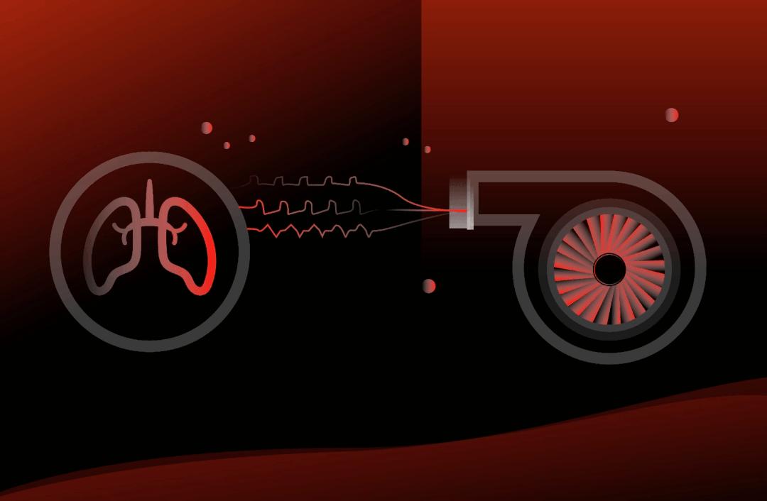 无创呼吸机一新亮点,无创通气和有创通气的优缺点