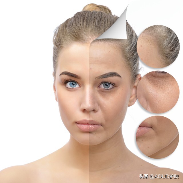 我的祛痘之路：从痘痘少女到ADUD创始人