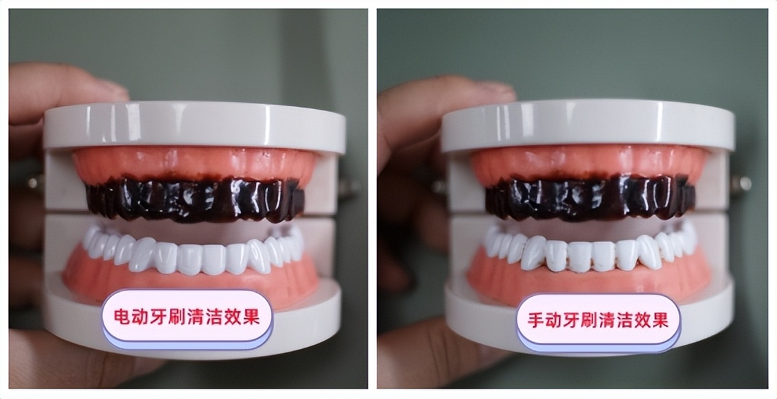 成人电动牙刷儿童用有什么问题,电动牙刷儿童1-3岁靠谱吗