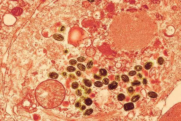 「双语阅读」人们最早是怎么开始接种疫苗的