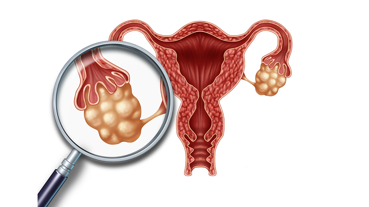 子宫内膜增厚和乳房疼有关系吗,子宫内膜增厚乳房胀痛
