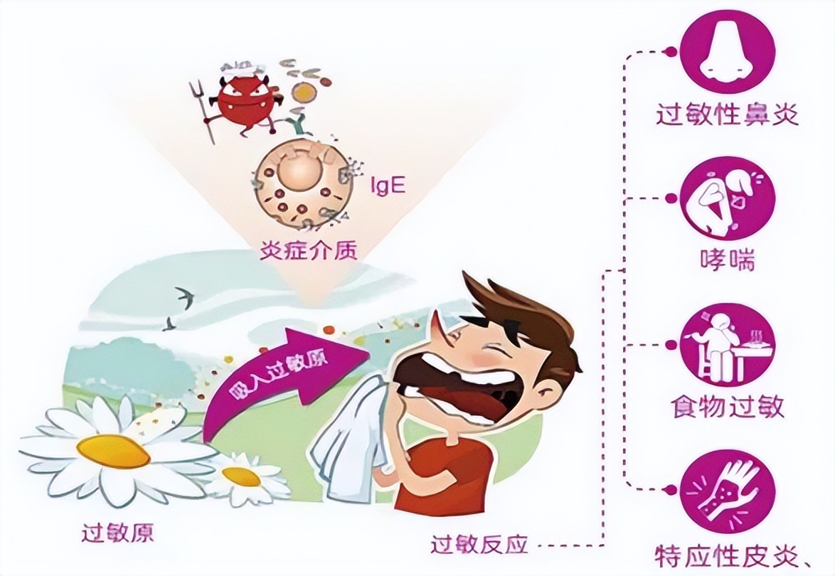 阿斯美复方甲氧那明胶囊消炎吗,阿斯美复方甲氧那明是抗生素药吗