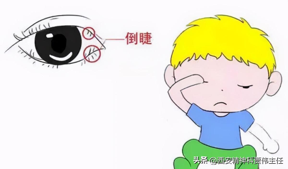 小学生频繁眨眼是什么原因,儿童3-4岁频繁使劲眨眼