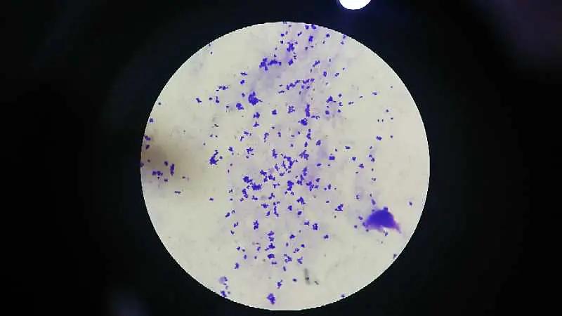 得了尿道炎会有哪些症状,尿道炎和膀胱炎的症状有什么区别