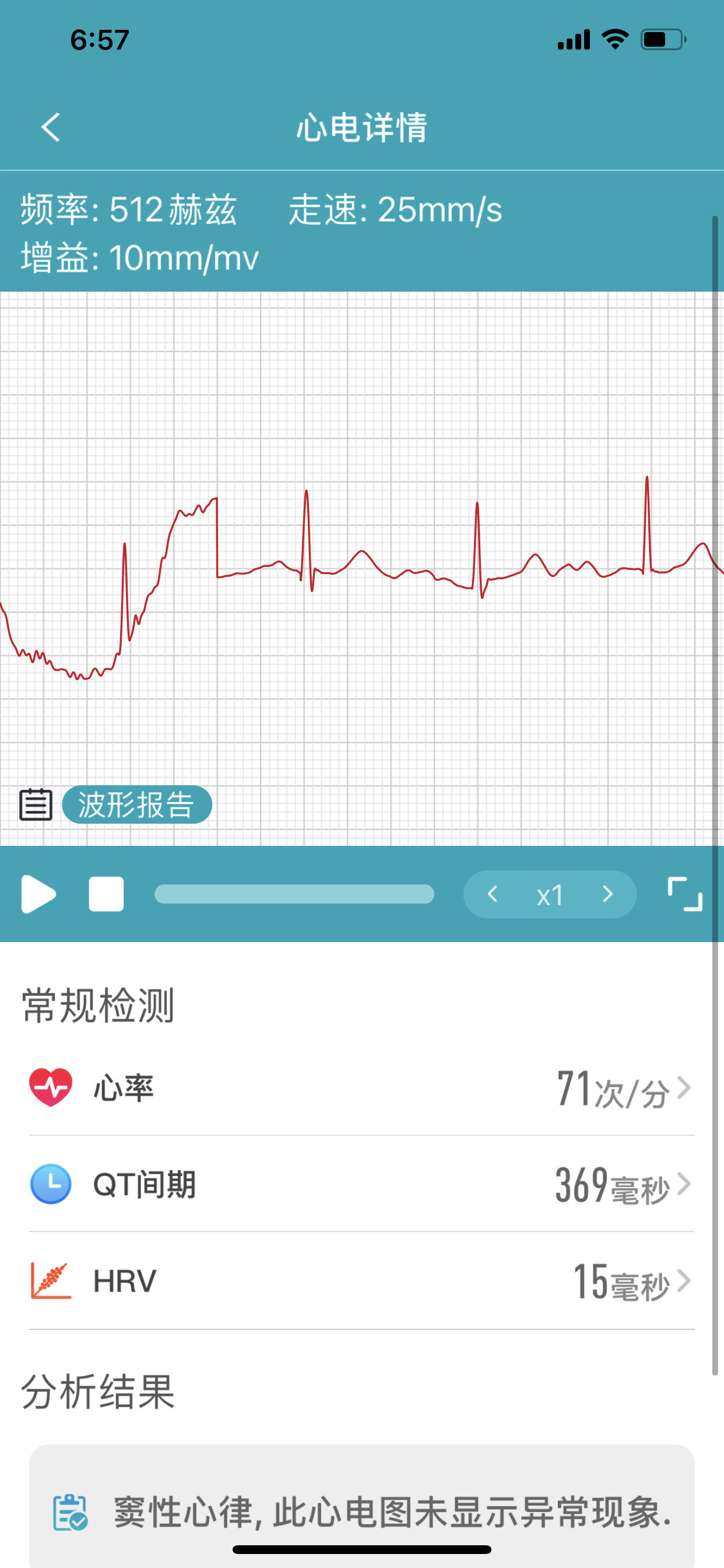 didog28spro智能健康手表,DIDOG28S血糖版智能手表