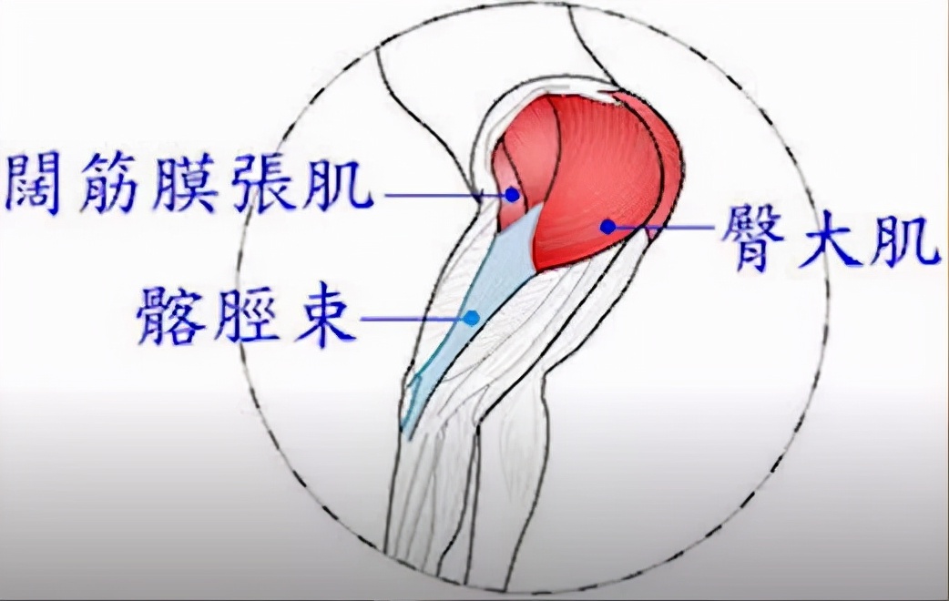 髂胫束会不会引起膝盖外侧疼痛,膝盖外侧髂胫束炎最好的治疗方法