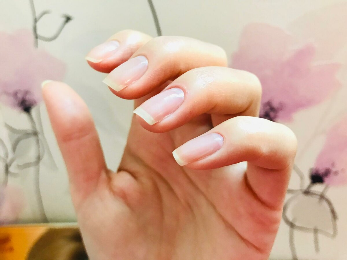 指甲渐变有条纹怎么解决,指甲薄有竖纹容易开裂不易长出来