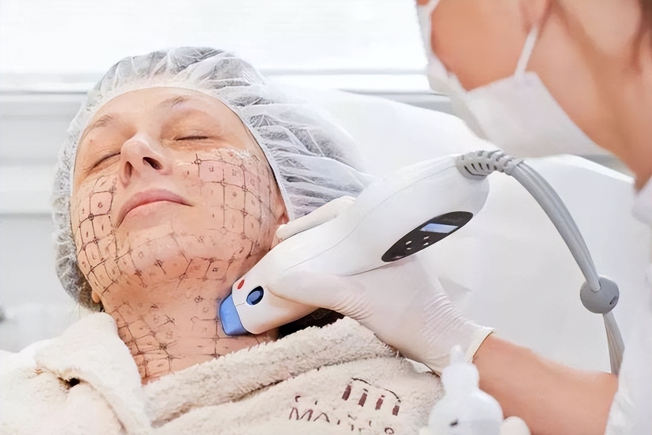 热玛吉是越年轻效果越好吗,热玛吉适合哪种肌肤