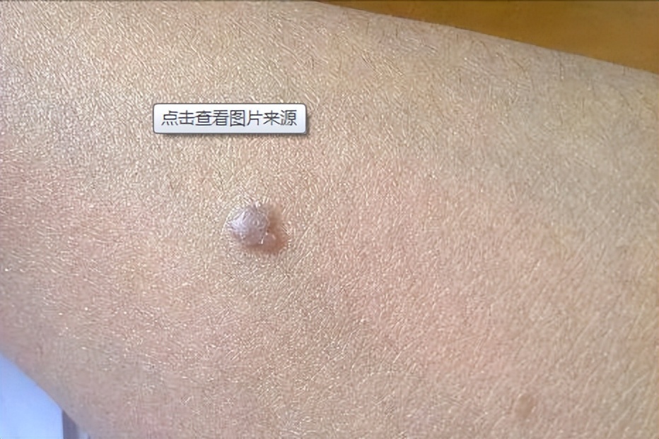 打九价会影响例假？别傻了，这些才是影响例假真正的原因