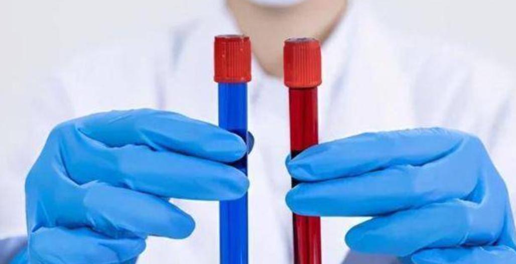 阴雨天浑身酸痛是怎么治疗,阴雨天全身疼痛是什么问题