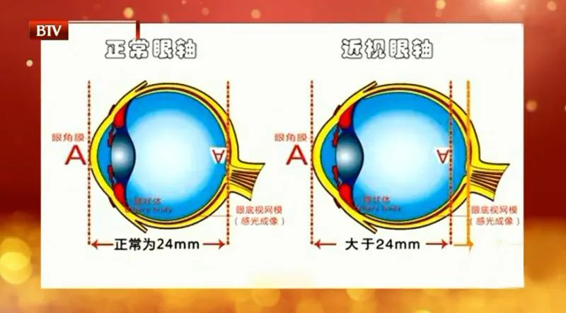 玩手机玩多了失明前兆,男子熬夜玩手机数小时差点失明