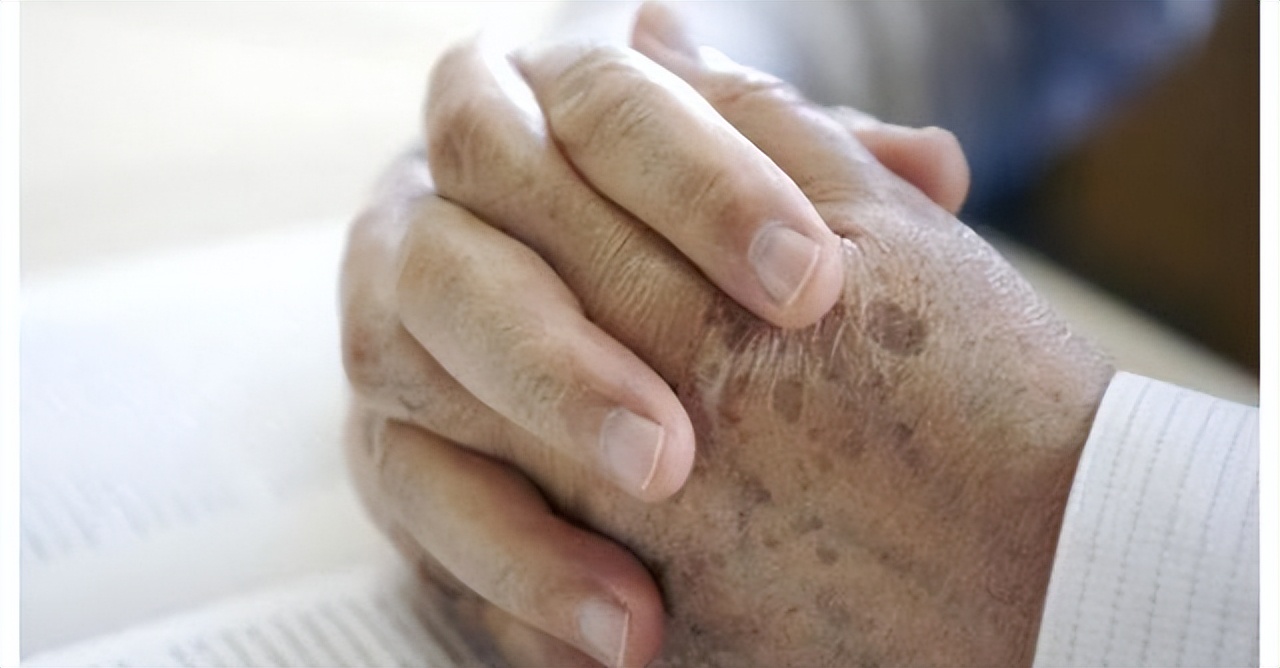 快速消除老年斑的小妙招红霉素,红霉素软膏可以去掉老人斑吗