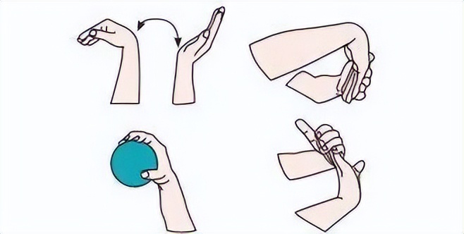 鼠标手、扳机指、键盘手、妈妈手……都是这个病