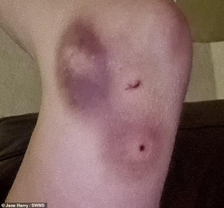 英国嗜血松鼠2天咬伤18人咬到出血!最终被抓起来安乐死