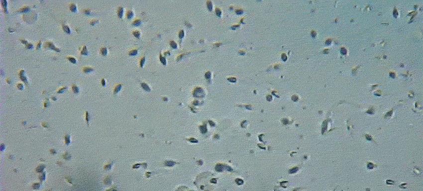 科学家精子运动违背牛顿第三定律,精子科学家