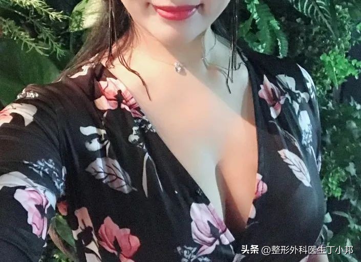 丁小邦博士介绍,整形医生丁小邦线雕