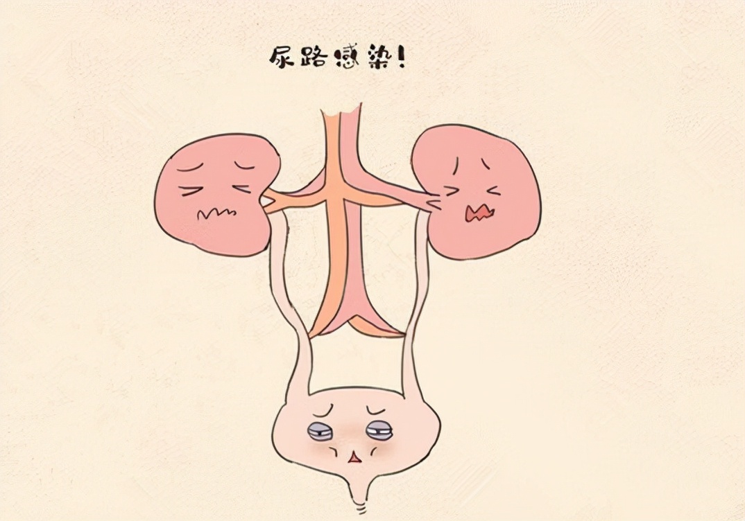尿常规能查出什么问题?那些常见数值都代表了什么?