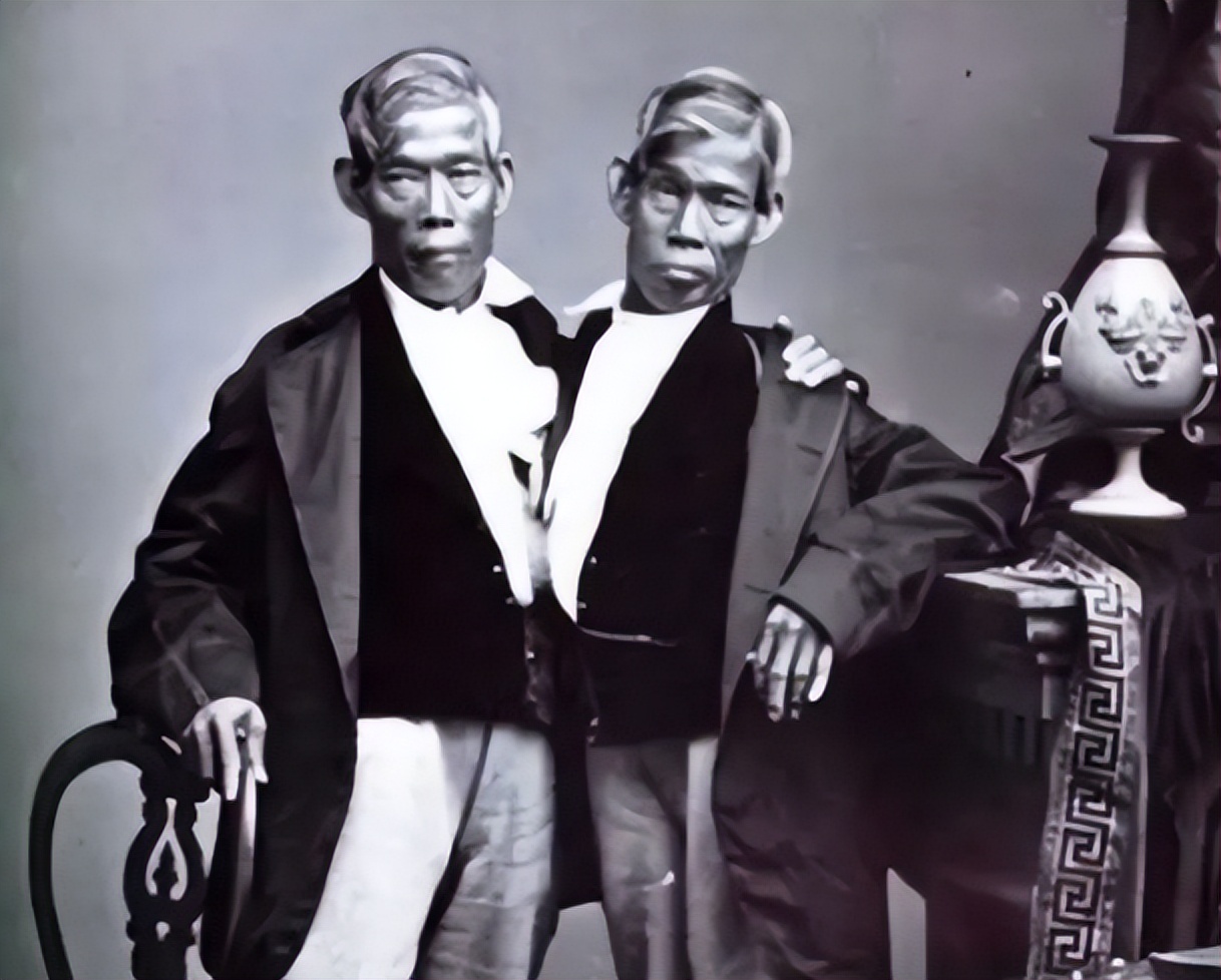 泰国连体兄弟娶美国姐妹,泰国连体兄弟娶双胞胎姐妹