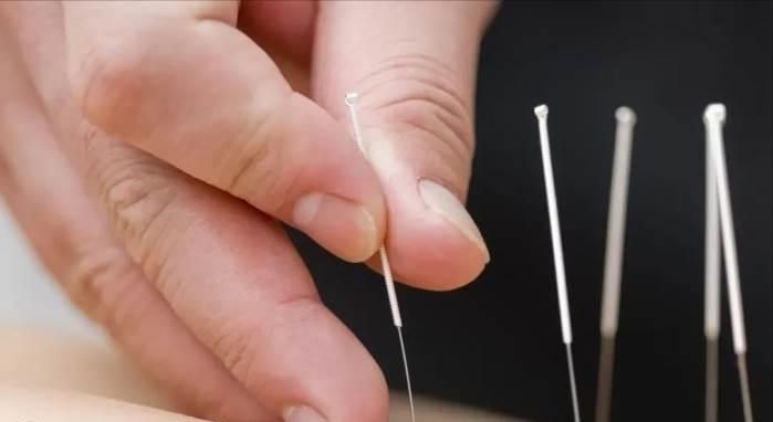 走进中医|运用中医岐黄针对中风后下肢痉挛症状的治疗