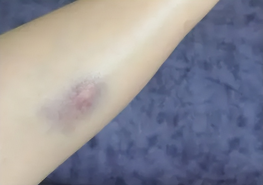 筋膜枪500以下评价,筋膜枪评测mini