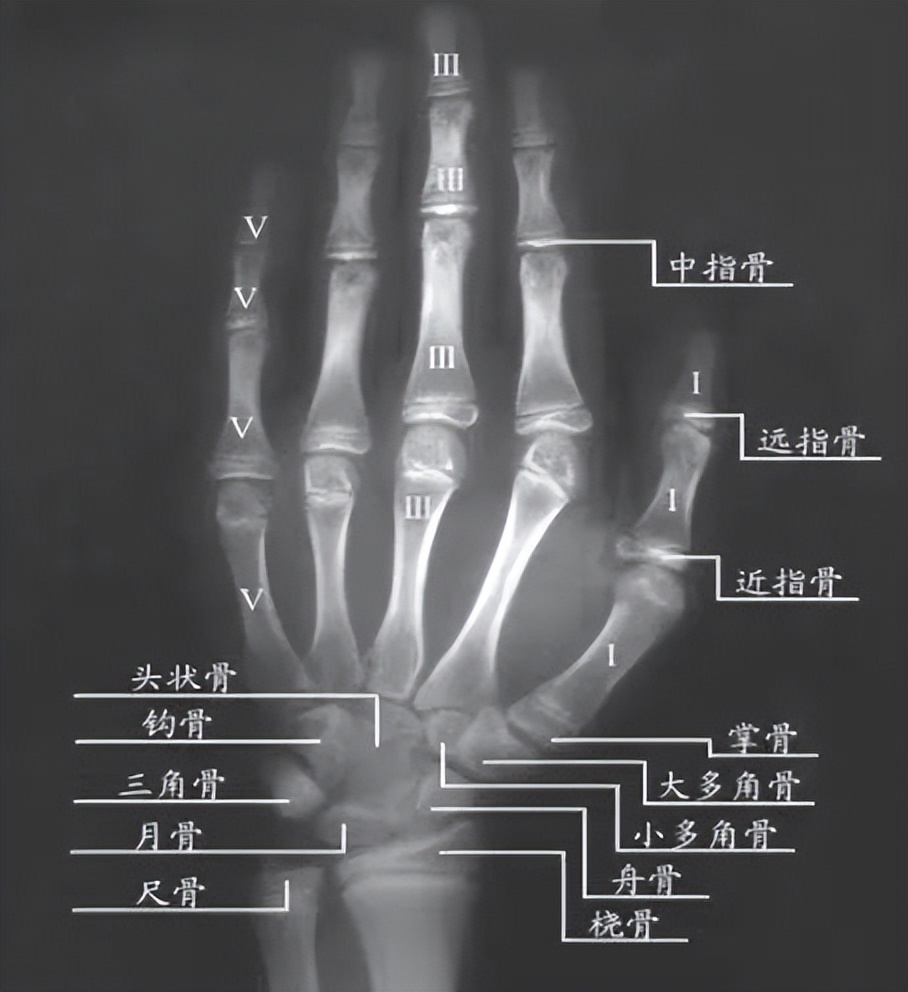 骨龄和身高有什么区别,骨龄知识科普视频比赛