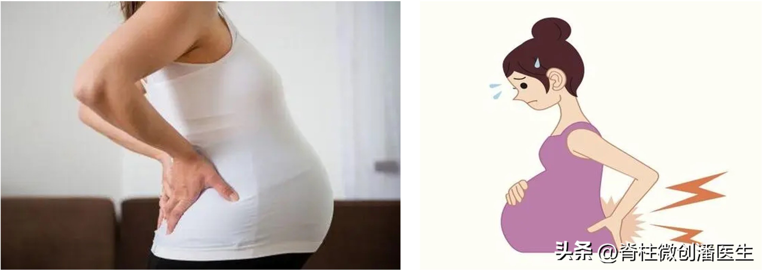 怀孕期间腰酸背疼怎么办,怀孕期间腰酸背疼是什么原因