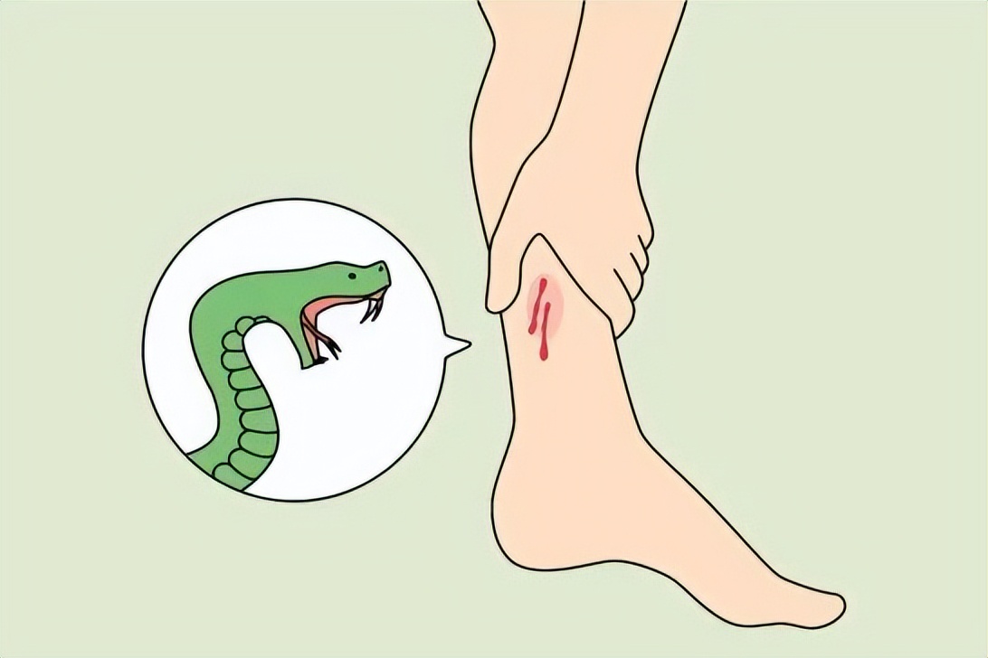 有蛇出没多地居民区如何防蛇,蛇出没最全防蛇手册来了