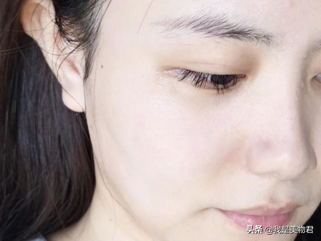 改善毛孔堵塞闭口粉刺,毛孔清道夫去闭口粉刺