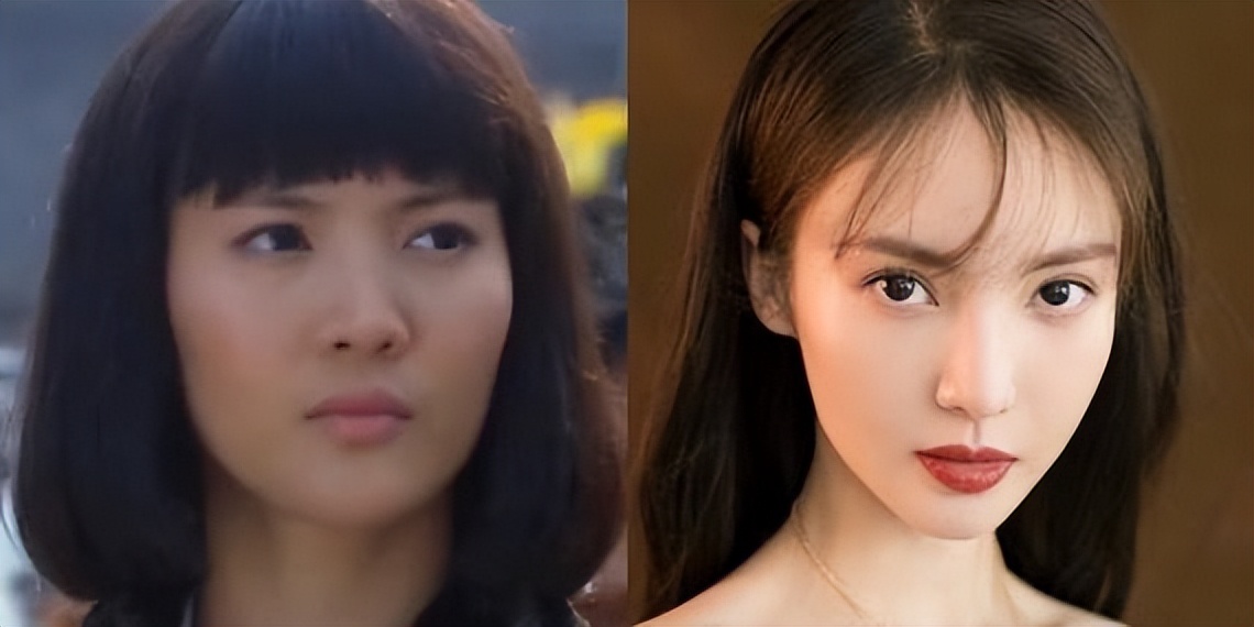 哪些明星整容后遗症越来越严重,整容明星后遗症对比图片