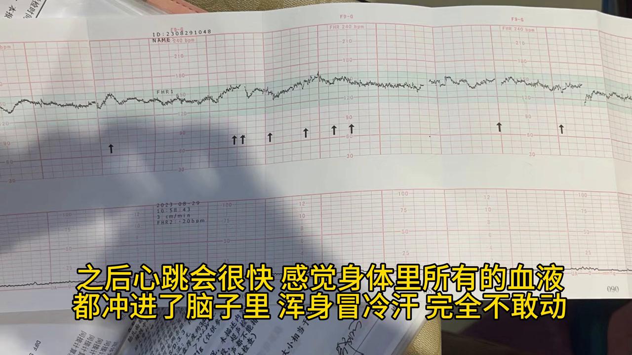 34周做胎监出现宫缩怎么回事,孕34周假性宫缩是什么感觉