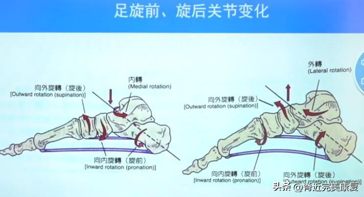 足底无力怎么改善,扁平足如何自我康复