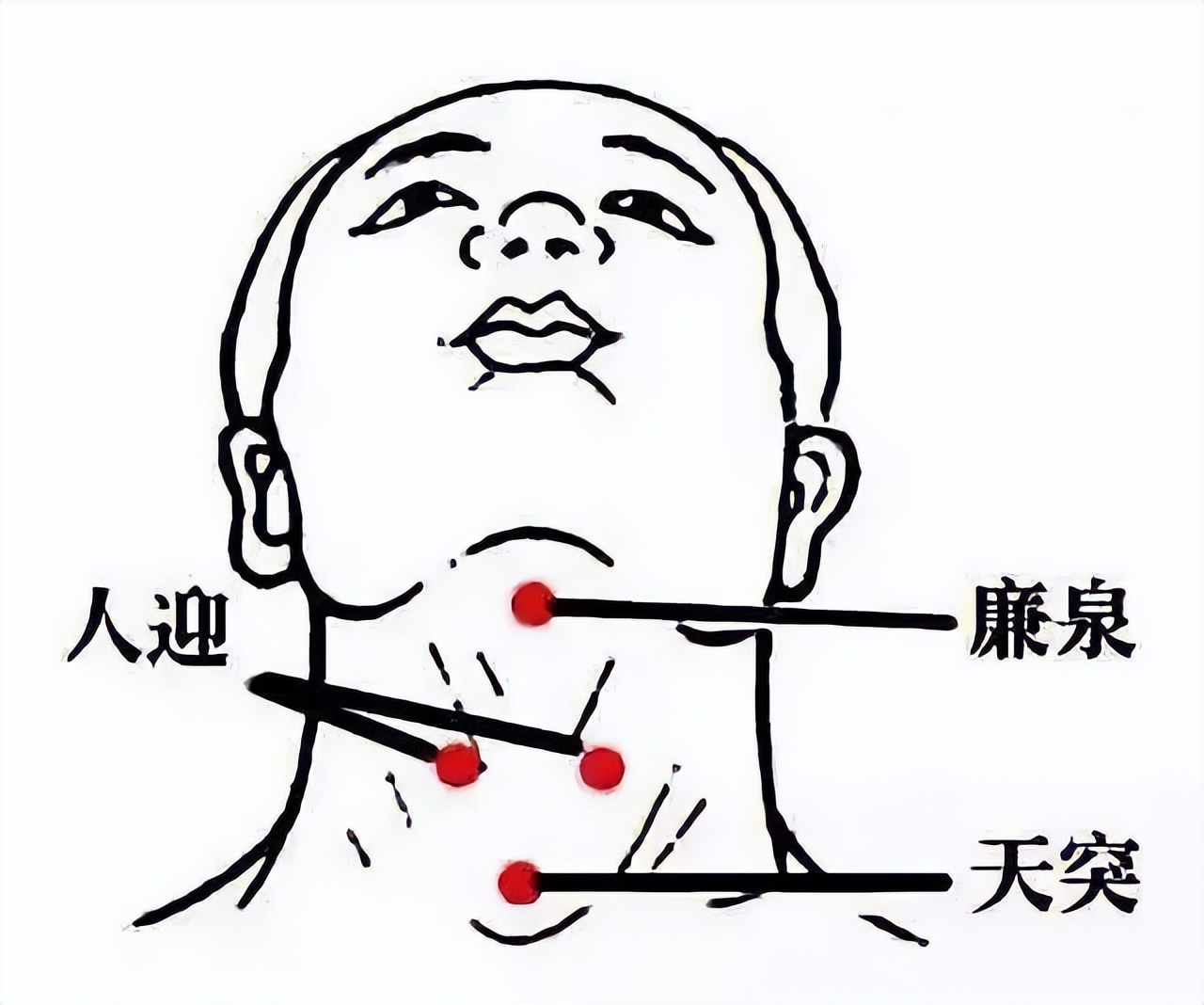 甲流后咳嗽不停怎么解决中医,甲流高发牢记这些应对措施