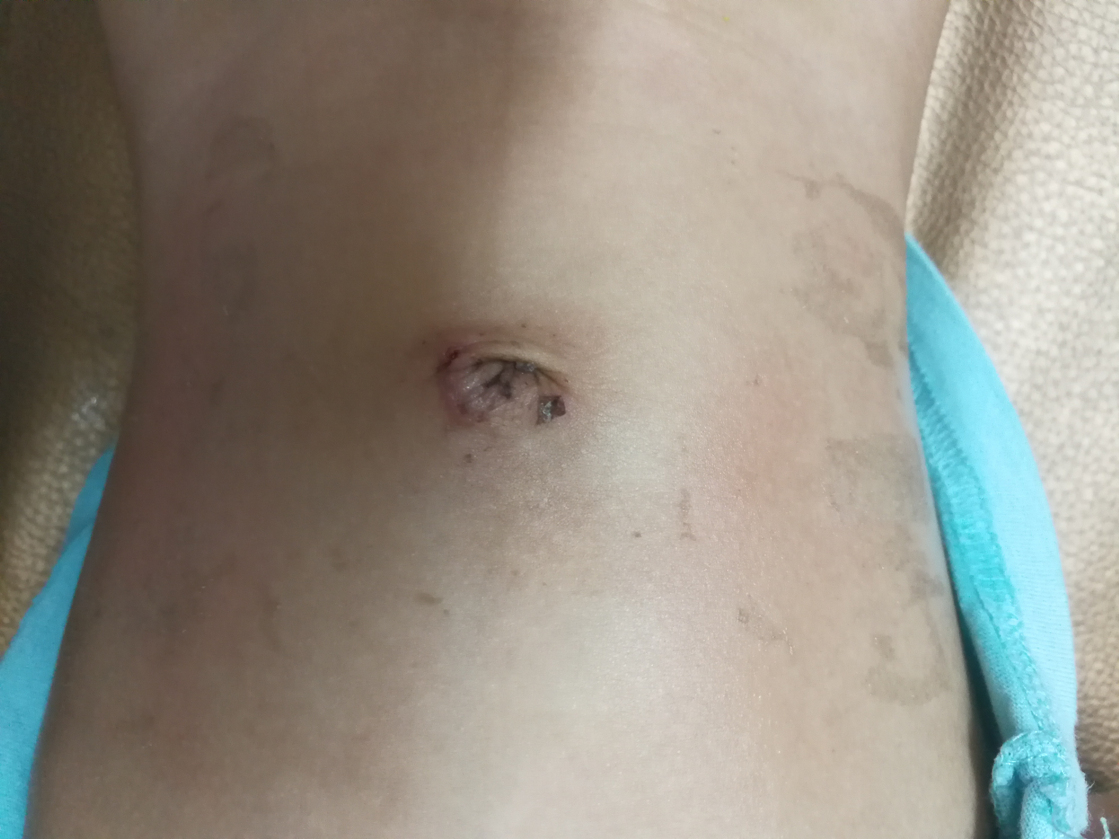 男宝阴囊里面没有“小蛋蛋”，后果可能很严重，家长别大意