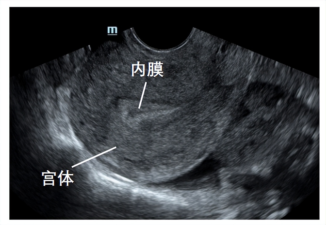 b超监测排卵显示不清是怎么回事,助孕好孕