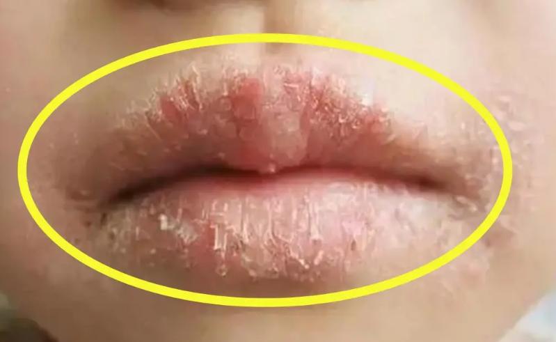 维生素b6一般是多少钱,维生素b6价格低的能吃吗