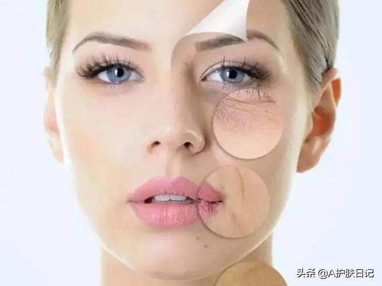 去皱纹抗衰老最有效方法,怎样快速去皱纹最有效