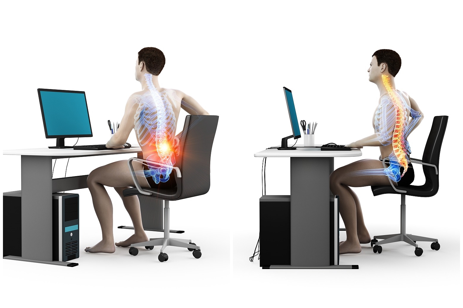 肌肉引起的腰痛怎么缓解,怎样练习腰部缓解腰痛