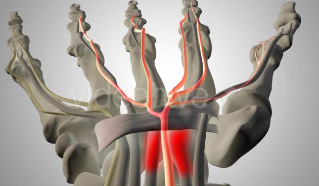 鼠标手手指麻木,鼠标手麻木无力