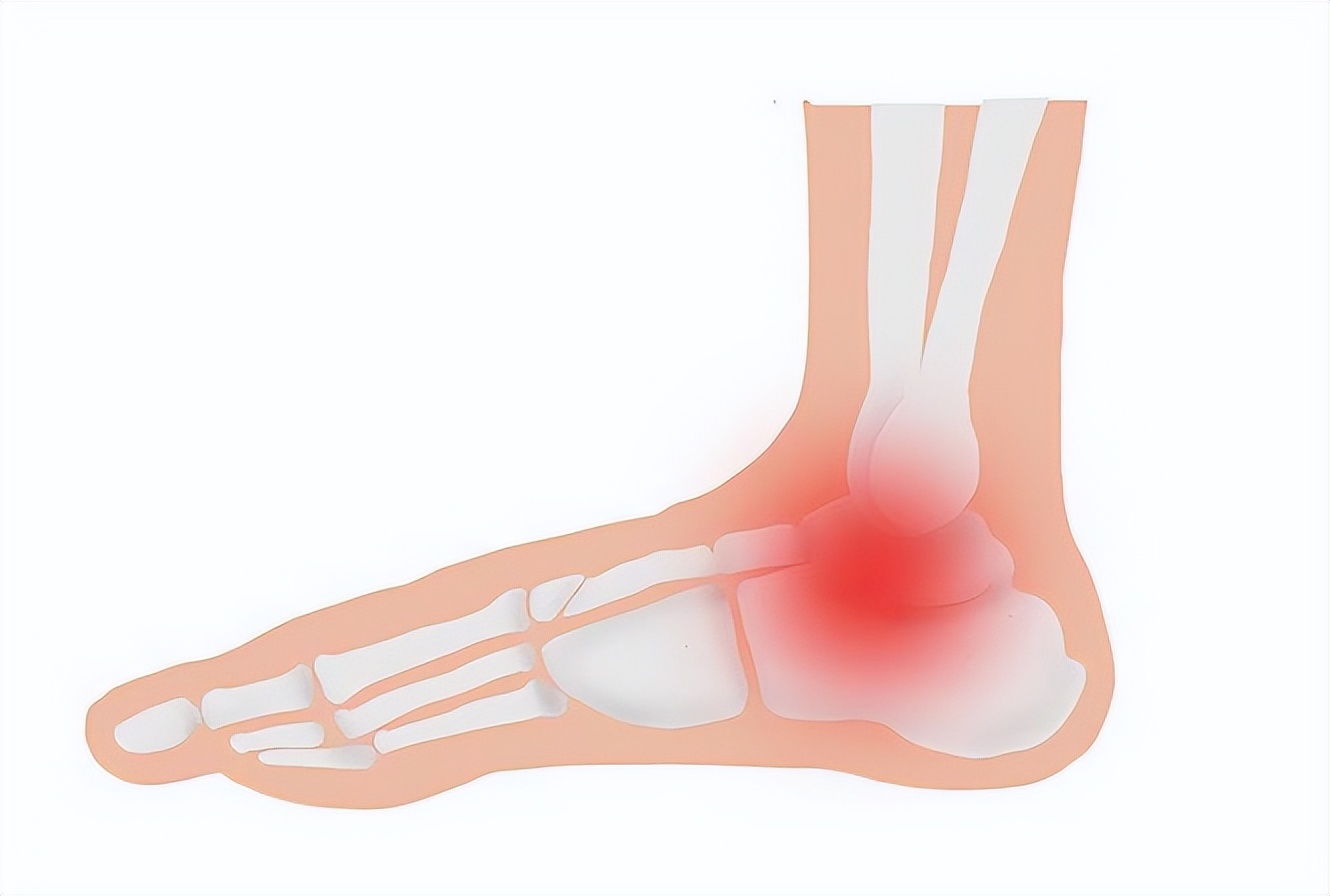 脚疼怎么判断是不是炎症引起的,脚胀痛难忍