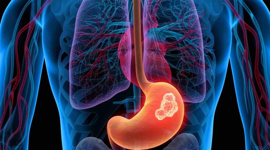 胃镜多久做一次合适正常人,胃镜多久做一次对身体没有危害